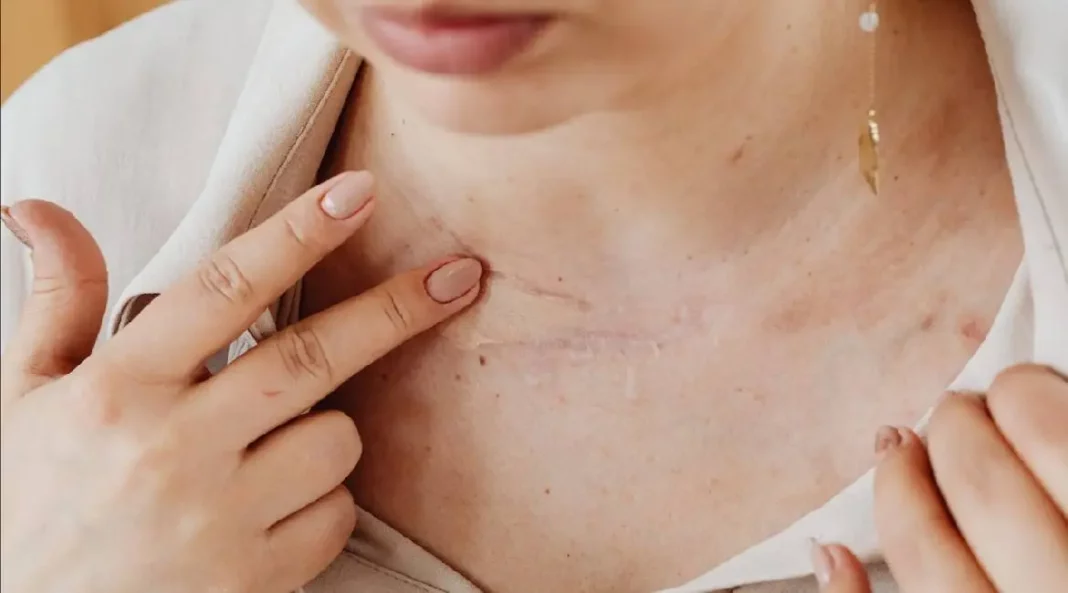saveti-koza_pexels
